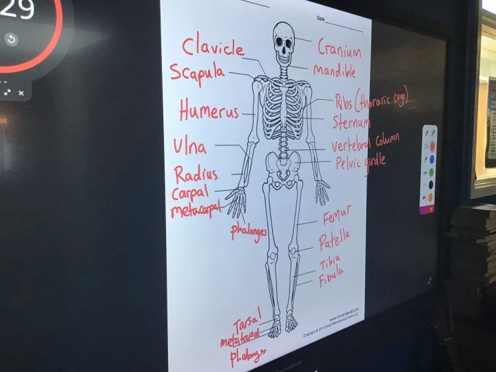 Bones1