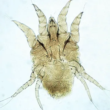 Chorioptic Sarcoptic Mite