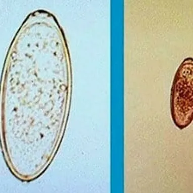 Pin Worm Test