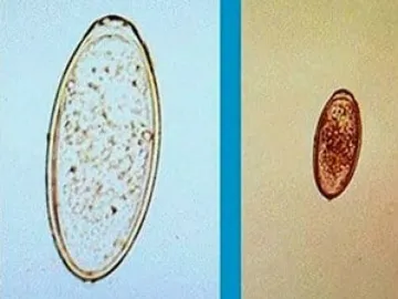 Pin Worm Test