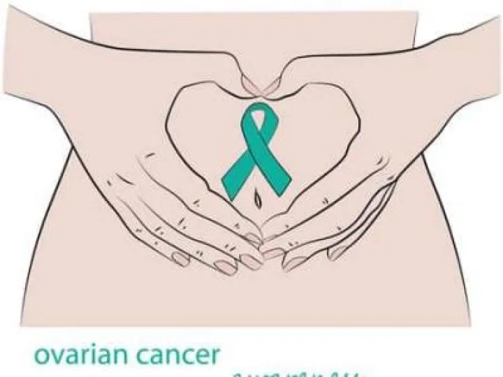 Ovarian Cancer Awareness